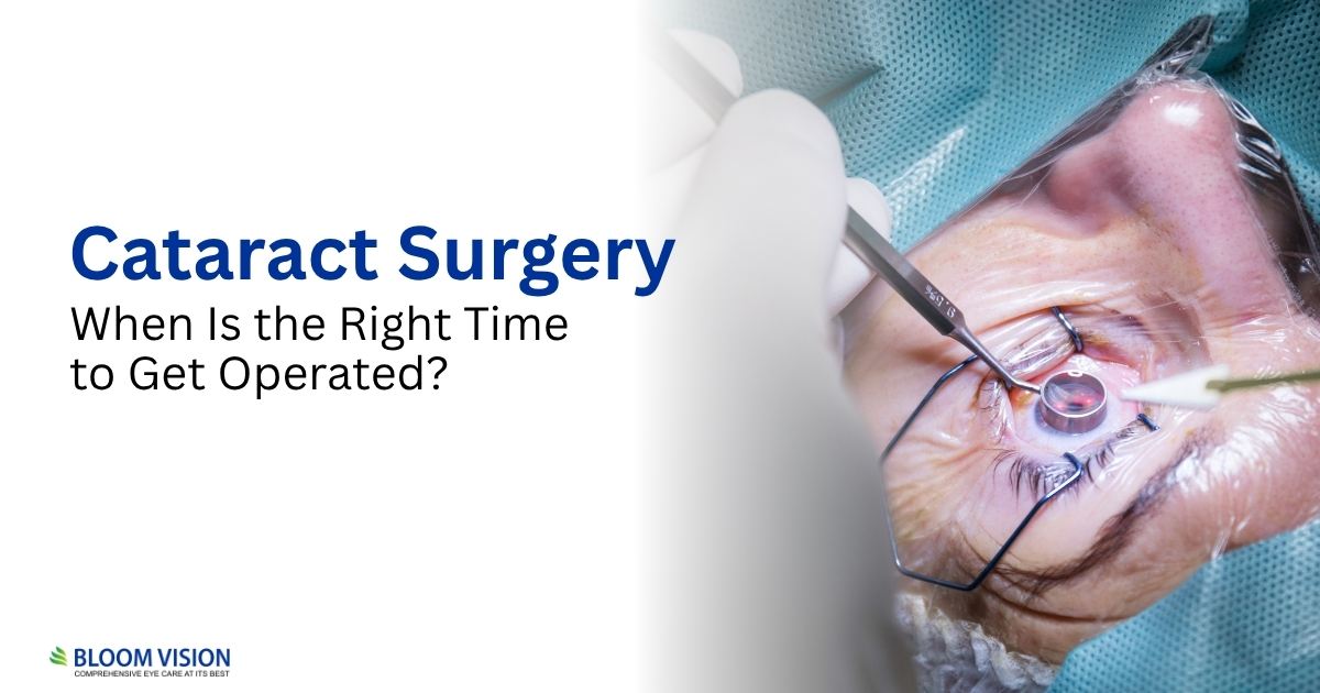 cataract surgery when is the right time to get operated
