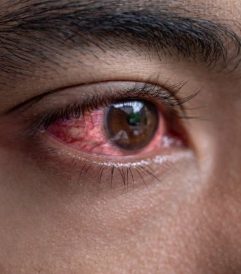 diabetic retinopathy screening & treatment bloom vision clinic