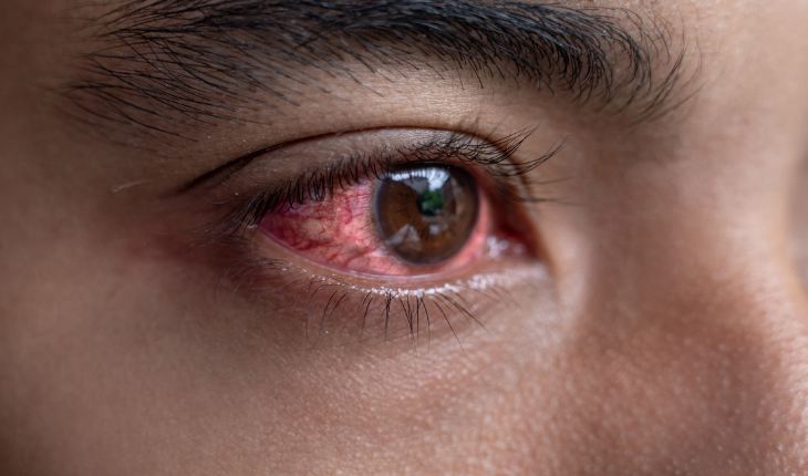 diabetic retinopathy screening & treatment bloom vision clinic