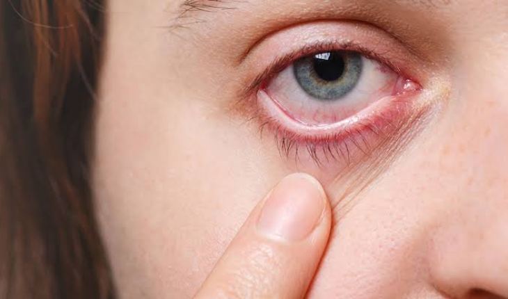 dry eye treatment bloom vision