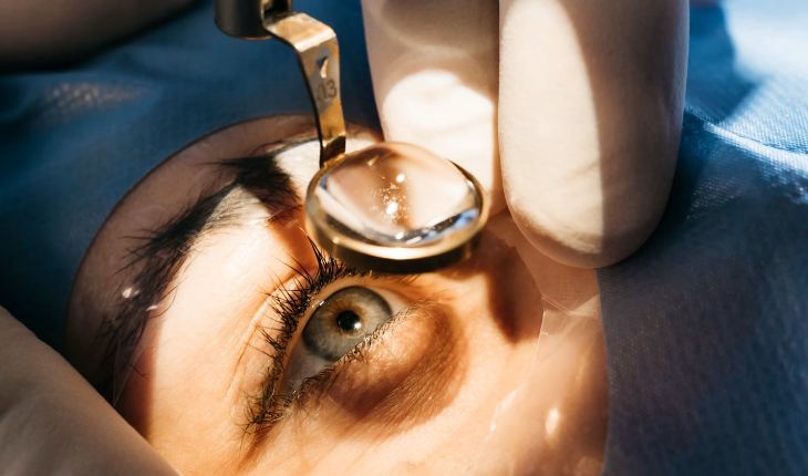 lasik, femtolasik & smile bloom vision clinic