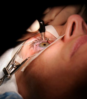 lasik, femtolasik & smile bloom vision clinic
